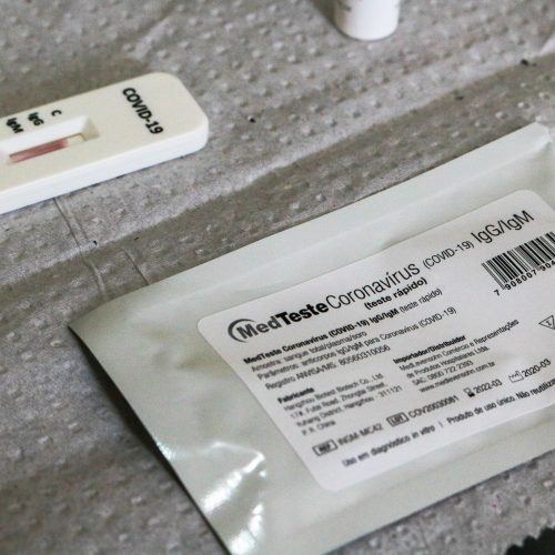 Testerapido_covid-19__foto_dayseeuzebio-10-1-500x500