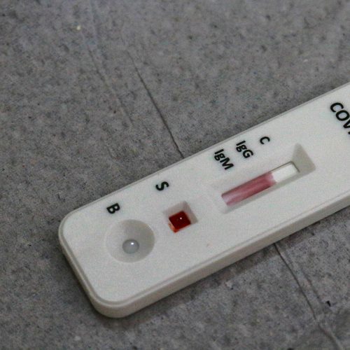 Testerapido_covid-19__foto_dayseeuzebio-8-500x500