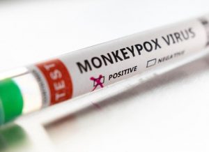 imagem-ilustrativa-monkeypox-reproducao-internet-300x218