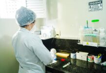 Exames de tuberculose são processados em laboratório próprio da Rede Municipal de Saúde